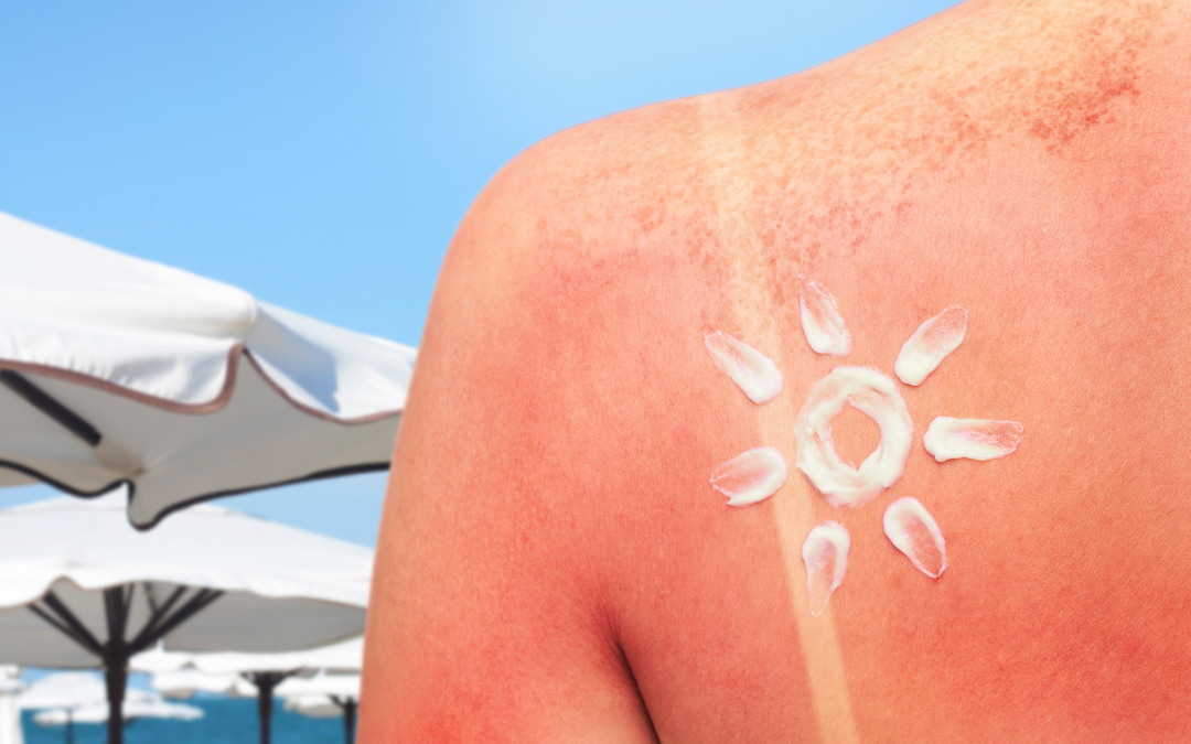 Sun Damage & Skin Repair: What You Need to Know