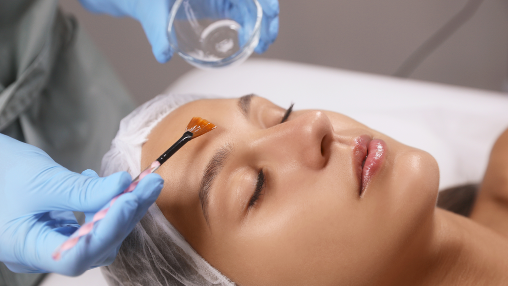 Chemical Peels Explained Are They Right for You