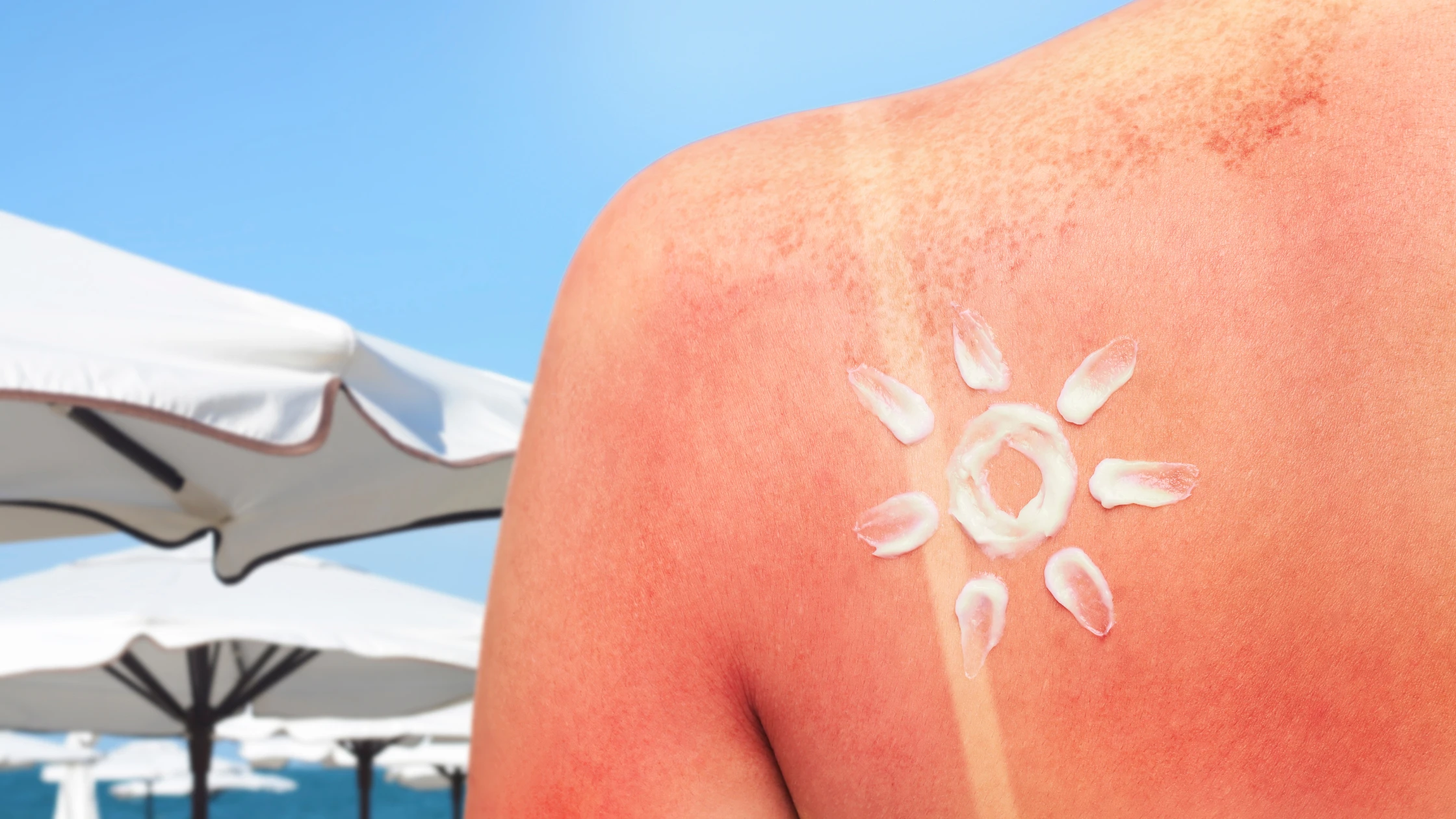 Blog #4 Sun Damage & Skin Repair What You Need to Know